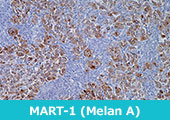 MART-1 (Melan A) (A103)