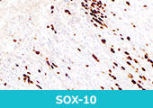 SOX-10 (EP268)